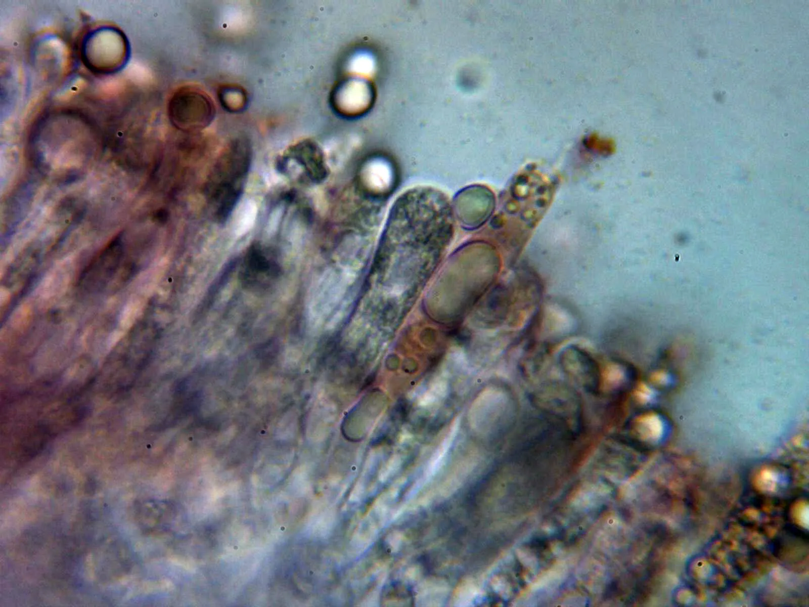 Microscopía de Paraxerula caussei - 10 - Basidios 1
